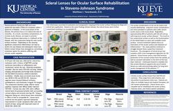 Scleral Lenses for Ocular Surface Rehabilitation in Stevens-Johnson